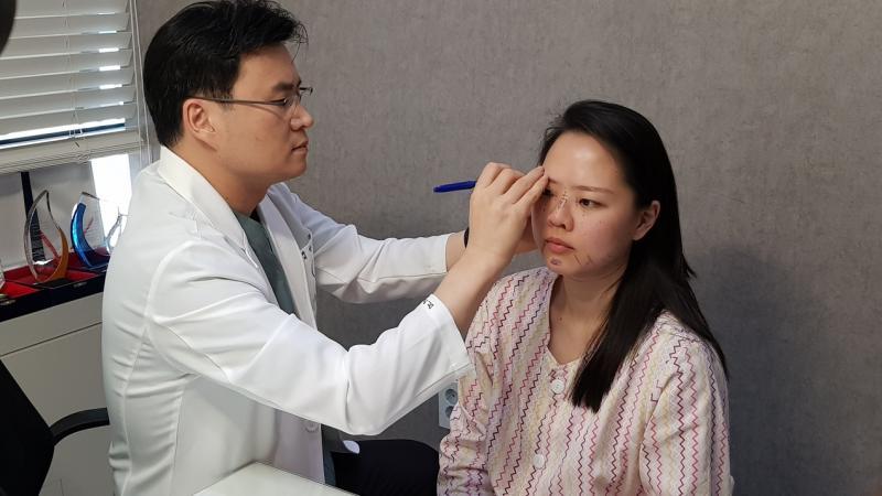 佳轮韩整形外科医院安泰柱医生在苏菲亚脸上“标示”修容的部位。