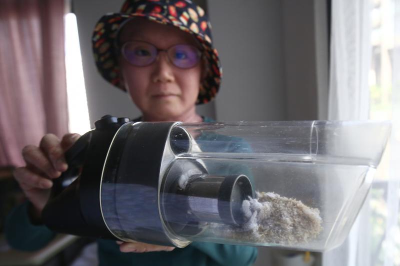 杨静睿每天会掉很多皮肤,必须天天清理。(陈斌勤摄)