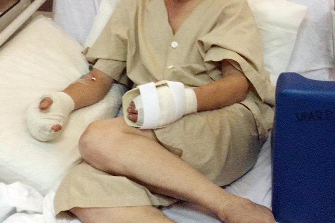 51岁的葛坤银发生工地意外受伤后被迫停工九个月,幸遇一群陌生人伸出援手,请他吃免费午晚餐、为车资卡充值,甚至提供物理治疗。(档案照)