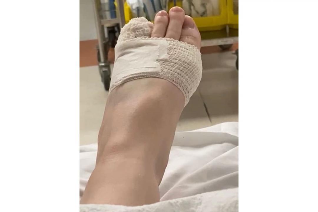 发生纠纷后,陈先生的妻子被送院治疗,诊断后发现她的脚趾骨折、多处淤青,手也被刮伤。(取自面簿)