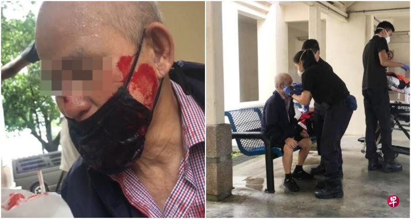 老汉跌倒后满脸是血,医护人员到场后帮忙处理伤口。。(取自面簿) 老汉跌倒后满脸是血,医护人员到场后帮忙处理伤口。。(取自面簿)