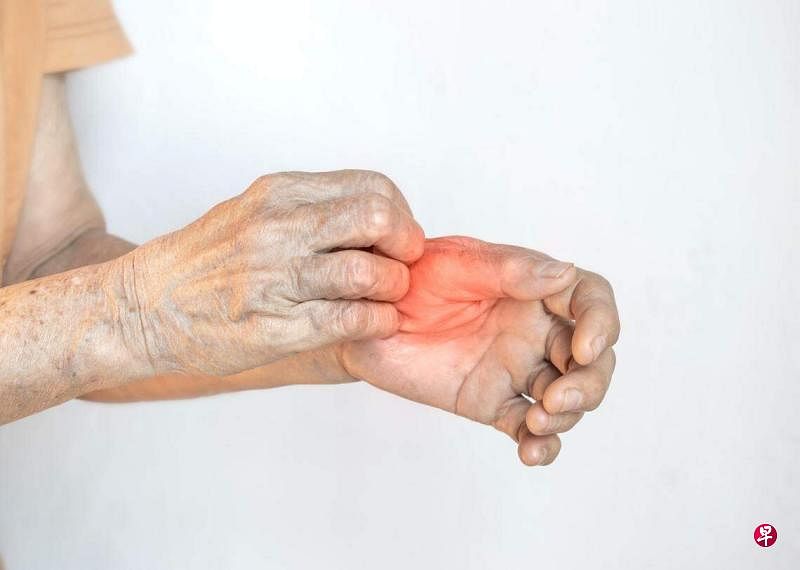 慢性瘙痒是65岁或以上年长者中最常见的皮肤问题。（iStock图片）
