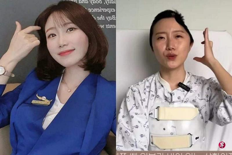 韩国网红Woozakka（禹恩彬，音译）过去曾担任过空姐，近日她突然透露自己年初遭遇重大事故，导致自己左半边头盖骨被削除。（互联网）