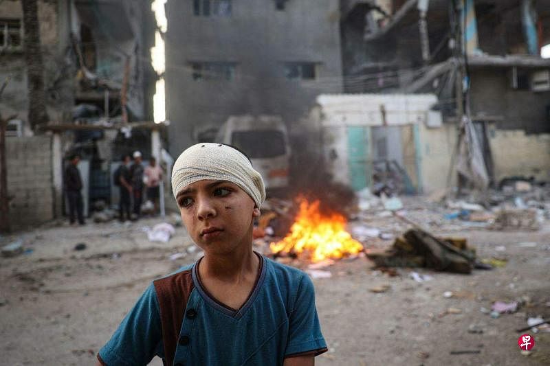 截至5月20日，以色列并未停止在加沙南部开展军事打击，图为一名头部受伤的巴勒斯坦男孩，无助地站在拉法市某一遇袭社区里。（法新社）