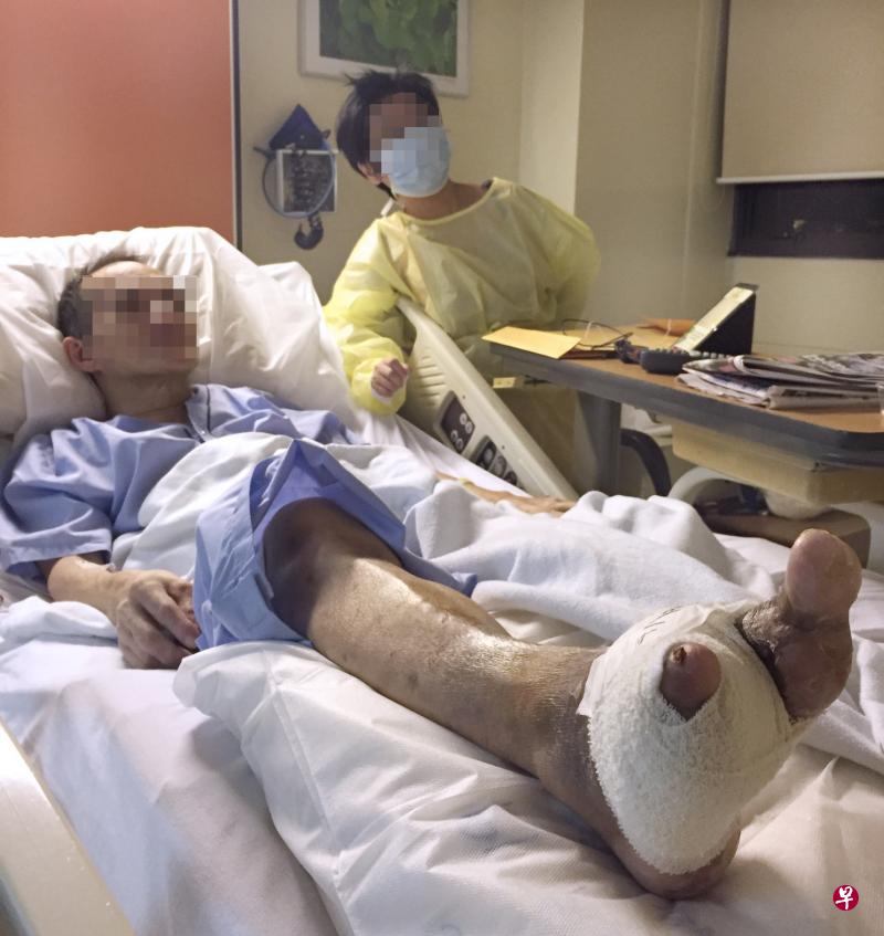 陈先生患上糖尿病,需切除三只脚趾,妻子为照顾他需公司医院两边跑。(受访者提供) 陈先生患上糖尿病,需切除三只脚趾,妻子为照顾他需公司医院两边跑。(受访者提供)