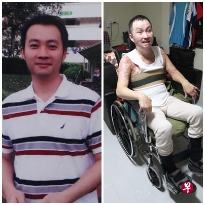 陈永耀出事时才30岁,如今坐轮椅,无法自理。 陈永耀出事时才30岁,如今坐轮椅,无法自理。