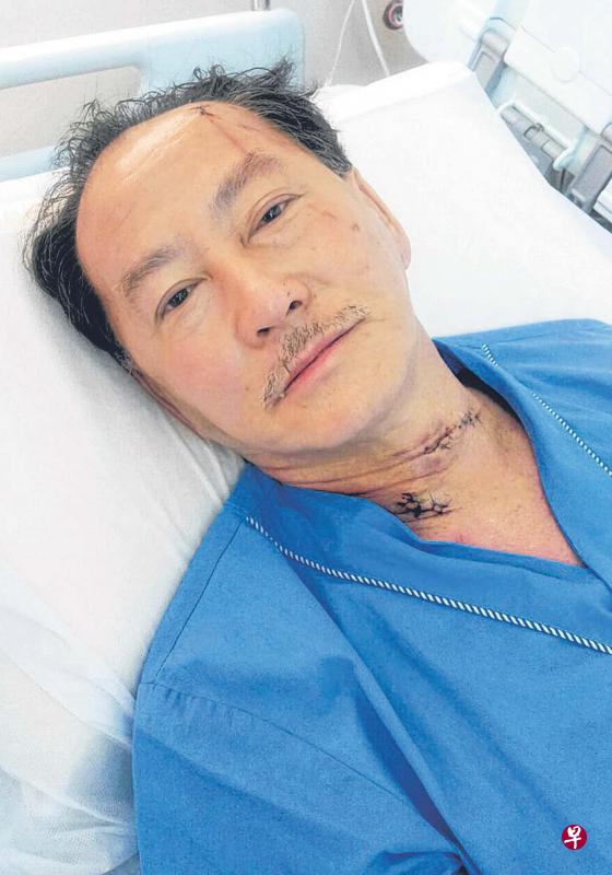 黄添顺颈部和头部遭刺伤,他过后被送往樟宜综合医院急救,昨早已脱离危险。(海峡时报) 黄添顺颈部和头部遭刺伤,他过后被送往樟宜综合医院急救,昨早已脱离危险。(海峡时报)