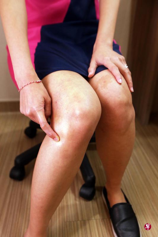 足三理穴 足三理穴