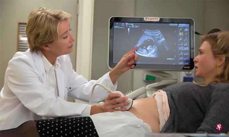 《BJ有喜》艾玛汤普森(左)演女医生,为意外怀孕的云妮产检。 《BJ有喜》艾玛汤普森(左)演女医生,为意外怀孕的云妮产检。