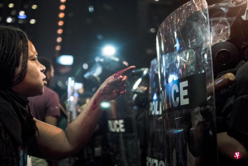 周三在夏洛特市,一名满手是血的示威者与警察对峙。示威者抗议警察乱杀人,结果酿成警民冲突。(法新社) 周三在夏洛特市,一名满手是血的示威者与警察对峙。示威者抗议警察乱杀人,结果酿成警民冲突。(法新社)