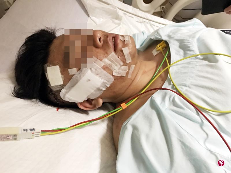 尤长安的脸部被玻璃碎片划破,伤得不轻。 尤长安的脸部被玻璃碎片划破,伤得不轻。
