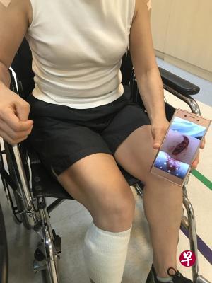 丁亦湻右边小腿被刺伤,伤口疼痛不堪 。 丁亦湻右边小腿被刺伤,伤口疼痛不堪 。