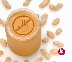 花生是常见的食物过敏原,可引发面部和喉咙肿胀等过敏反应,严重时可致死亡。(互联网) 花生是常见的食物过敏原,可引发面部和喉咙肿胀等过敏反应,严重时可致死亡。(互联网)