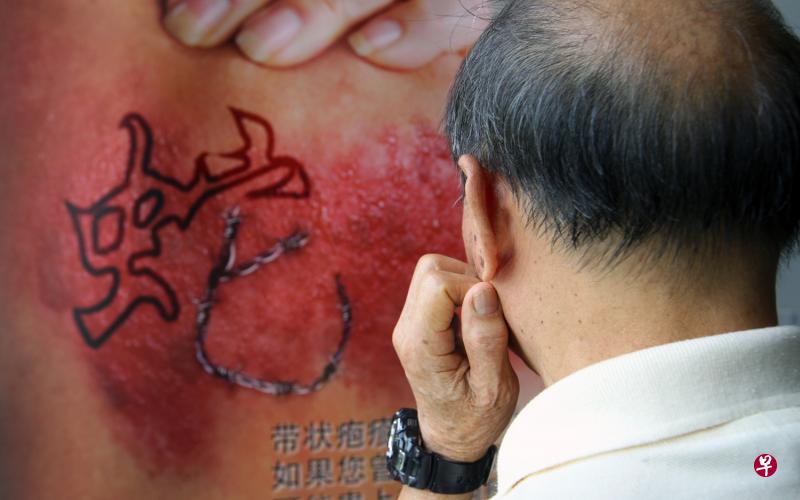 任何年龄层都可能“生蛇”。(档案照) 任何年龄层都可能“生蛇”。(档案照)