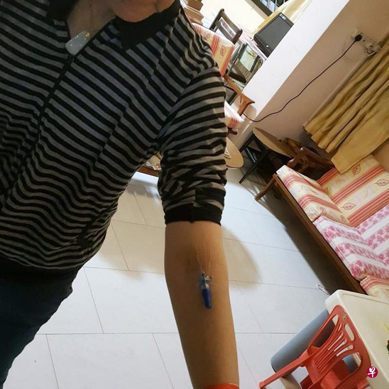 母亲出院后,发现医院职员并没拔出手臂上的静脉输液针。(取自面簿) 母亲出院后,发现医院职员并没拔出手臂上的静脉输液针。(取自面簿)