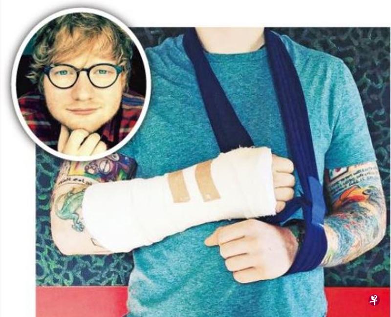 Ed Sheeran(圆图)未有公布伤势轻重,令粉丝担心不已。 Ed Sheeran(圆图)未有公布伤势轻重,令粉丝担心不已。
