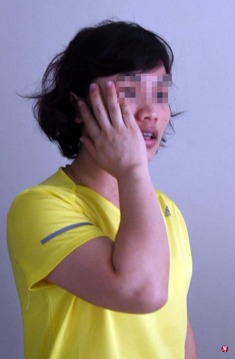 李琳淋向记者演示自己被掌掴。 李琳淋向记者演示自己被掌掴。