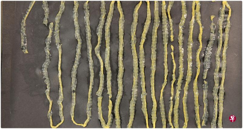 中央医院前年有一起感染寄生虫病例,病人排出一条2.8公尺长绦虫。院方将它折了18次才能拍照以留下记录。(《星期日时报》) 中央医院前年有一起感染寄生虫病例,病人排出一条2.8公尺长绦虫。院方将它折了18次才能拍照以留下记录。(《星期日时报》)