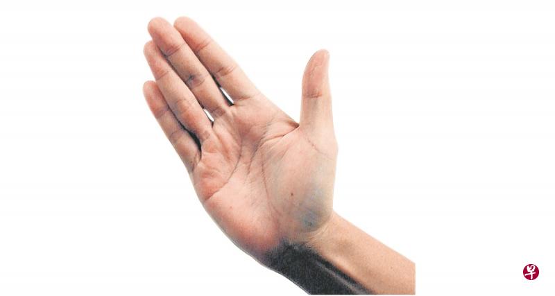 27岁女子要求动手术减缓经痛被拒绝,当场抓狂,掌掴临盆在即的医生的左脸颊。(档案示意图) 27岁女子要求动手术减缓经痛被拒绝,当场抓狂,掌掴临盆在即的医生的左脸颊。(档案示意图)