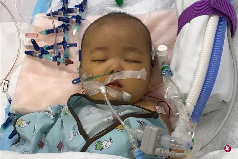 动了12个小时的手术,六个月大的宝宝张子谦目前未苏醒,父母陪伴在侧。(受访者提供) 动了12个小时的手术,六个月大的宝宝张子谦目前未苏醒,父母陪伴在侧。(受访者提供)
