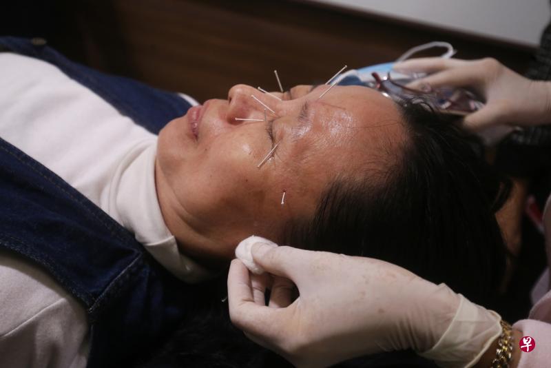 参与临床研究的干眼患者陈华妹,在接受针灸和眼药水治疗后,症状显著改善。针灸眼周穴位约10分钟后,她因泪腺受刺激,流下眼泪。(林国明摄) 参与临床研究的干眼患者陈华妹,在接受针灸和眼药水治疗后,症状显著改善。针灸眼周穴位约10分钟后,她因泪腺受刺激,流下眼泪。(林国明摄)