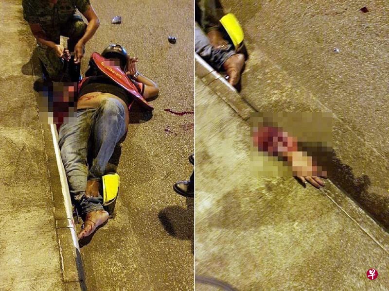 电单车骑士的手臂被接回。(取自面簿) 电单车骑士的手臂被接回。(取自面簿)