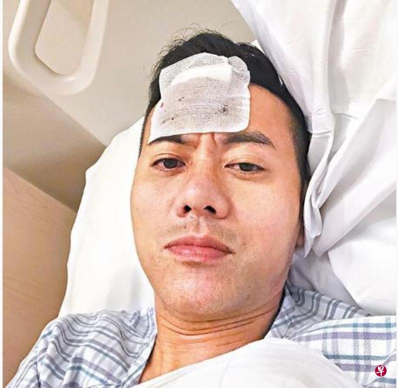 梁汉文昨日凌晨在社交网贴睡在病床照,原来他跌倒撞伤头。(图:网络) 梁汉文昨日凌晨在社交网贴睡在病床照,原来他跌倒撞伤头。(图:网络)