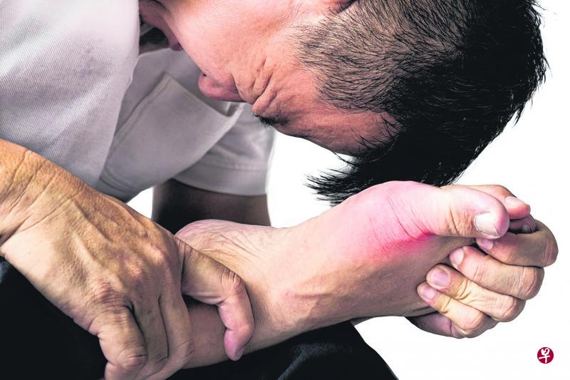 痛风一般会影响大脚趾,但膝盖、脚踝、手腕和手掌等关节部位也有可能受影响。(iStock图片) 痛风一般会影响大脚趾,但膝盖、脚踝、手腕和手掌等关节部位也有可能受影响。(iStock图片)
