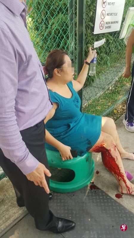 本月28日下午,榜鹅培道中学外发生了野猪袭击孕妇的事件。(取自面簿) 本月28日下午,榜鹅培道中学外发生了野猪袭击孕妇的事件。(取自面簿)