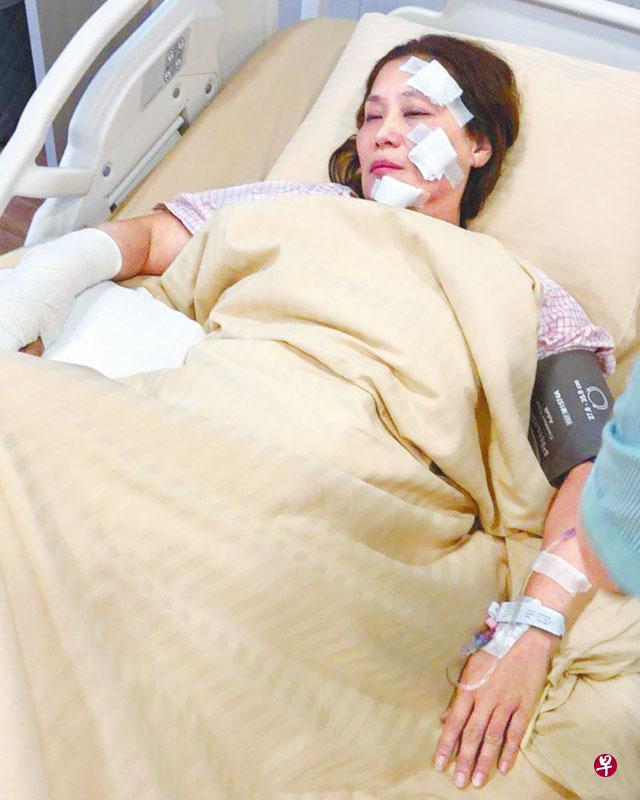 杨盼盼拍火灾戏,火势失控,导致她7%二度烧伤。(中国报) 杨盼盼拍火灾戏,火势失控,导致她7%二度烧伤。(中国报)