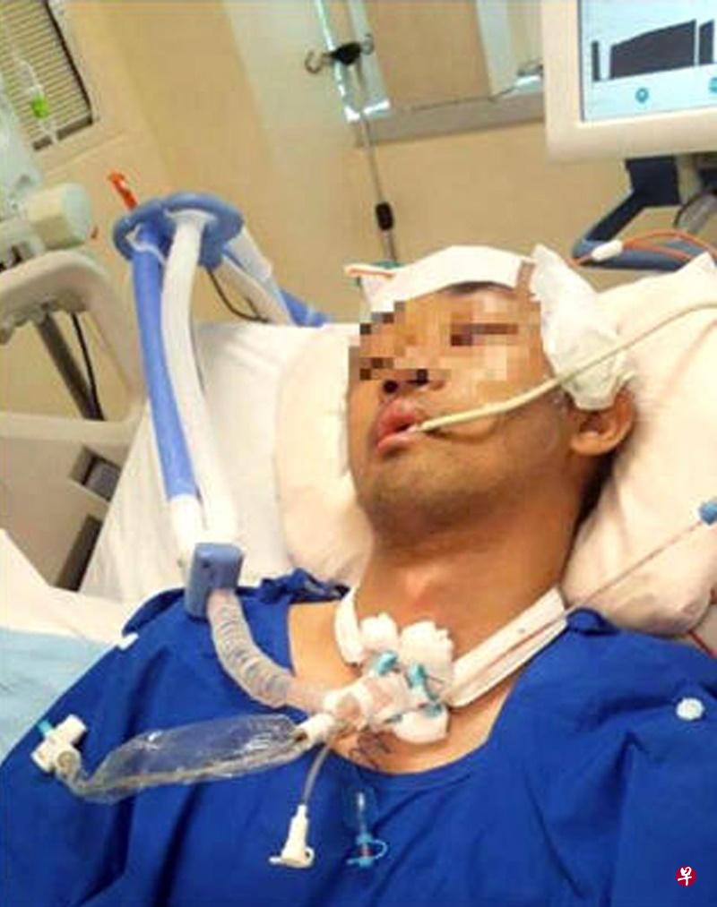 伤者林庆彪车祸后一度陷入昏迷。(档案照) 伤者林庆彪车祸后一度陷入昏迷。(档案照)