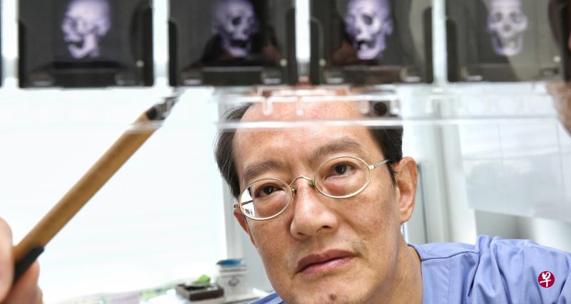 本地著名整形医生吴志良当年在公共医院行医时,几乎每个月都会动两三起至少八个小时的大型脸部修复手术。(陈福洲摄) 本地著名整形医生吴志良当年在公共医院行医时,几乎每个月都会动两三起至少八个小时的大型脸部修复手术。(陈福洲摄)