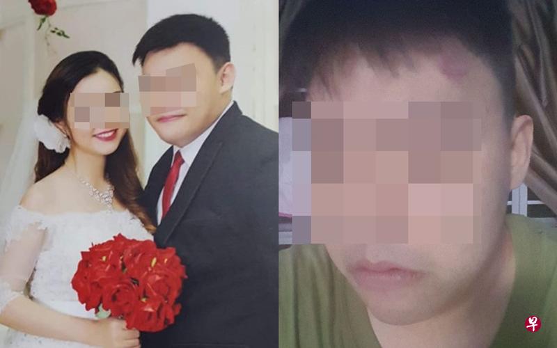 左图:沈先生出示和越南妻的结婚照。右图:沈先生申诉妻子以衣架毒打他,导致他的额头淤青。(受访者提供) 左图:沈先生出示和越南妻的结婚照。右图:沈先生申诉妻子以衣架毒打他,导致他的额头淤青。(受访者提供)