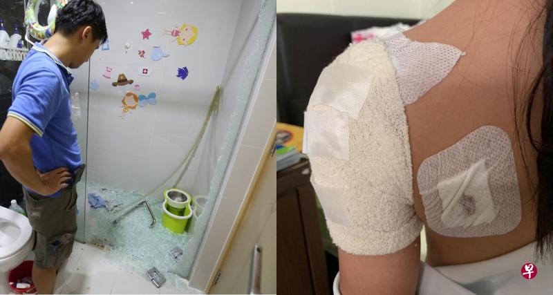 (左)屋主陈先生说,浴室玻璃门突然爆裂,碎片掉满地。(右)八岁小姐姐的背部受伤。(受访者提供) (左)屋主陈先生说,浴室玻璃门突然爆裂,碎片掉满地。(右)八岁小姐姐的背部受伤。(受访者提供)