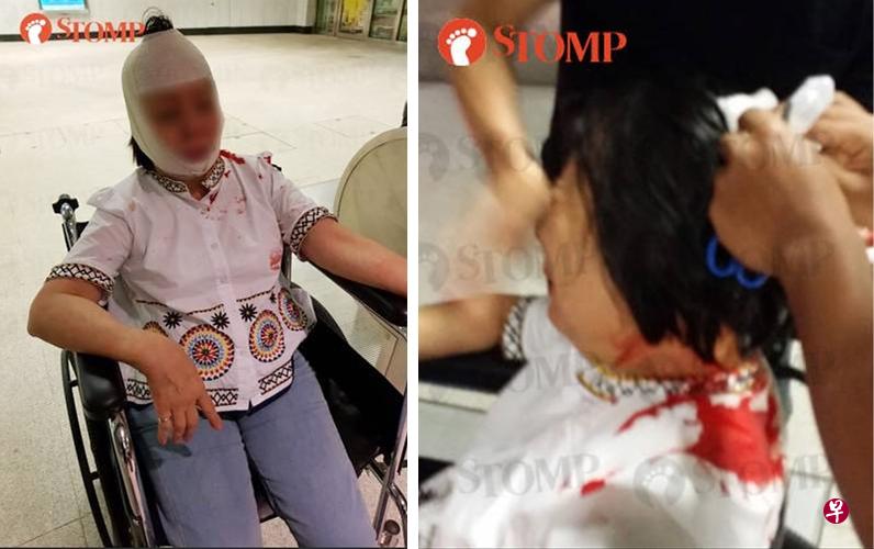 女郎头部受伤,鲜血染红了白色上衣。(Stomp) 女郎头部受伤,鲜血染红了白色上衣。(Stomp)