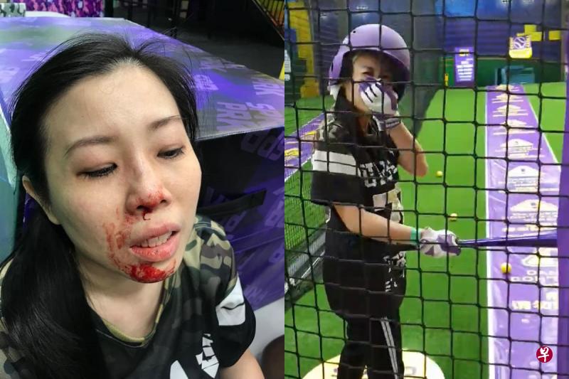 陈葆珊打到第四个球时,球打中旁边的支柱再弹到她脸上,她当场捂住鼻子,转过后看着背后正在拍视频的朋友(右图)。陈葆珊被球打中鼻梁后满脸是血(左图)。 陈葆珊打到第四个球时,球打中旁边的支柱再弹到她脸上,她当场捂住鼻子,转过后看着背后正在拍视频的朋友(右图)。陈葆珊被球打中鼻梁后满脸是血(左图)。
