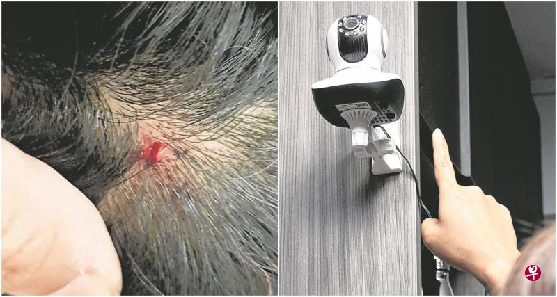 女童被女佣用猫抓板打伤,头破皮流血(左图)。事发后,女童的母亲花了百多元在厨房和客厅安装闭路电视。 女童被女佣用猫抓板打伤,头破皮流血(左图)。事发后,女童的母亲花了百多元在厨房和客厅安装闭路电视。