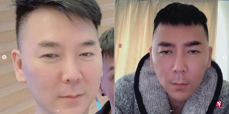 上图为李荣达整容前;右图是整容后的样子。 上图为李荣达整容前;右图是整容后的样子。