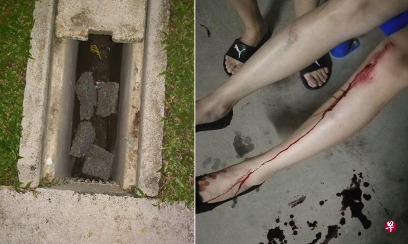 李女士因脚下的沟渠盖突然断裂而跌倒。（右图）李女士割伤左脚，血流如注。（受访者提供）
