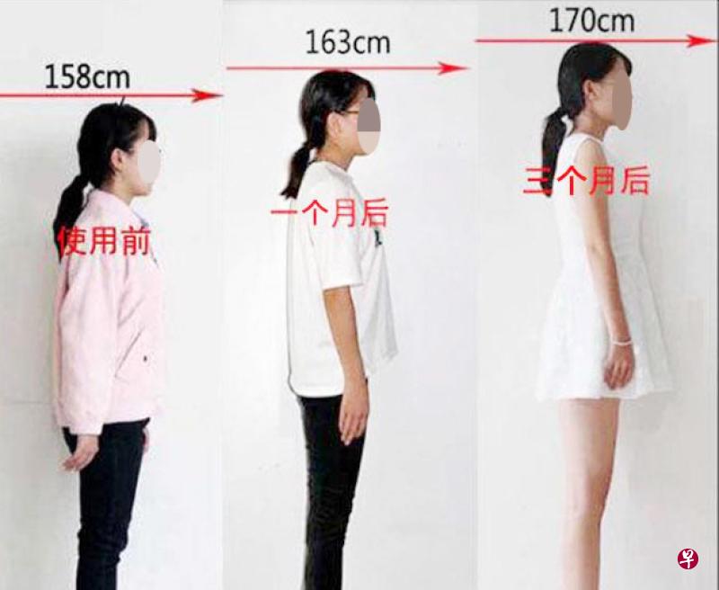 “增高精油”广告宣称让使用者在3个月内长高12公分。(网络照) “增高精油”广告宣称让使用者在3个月内长高12公分。(网络照)