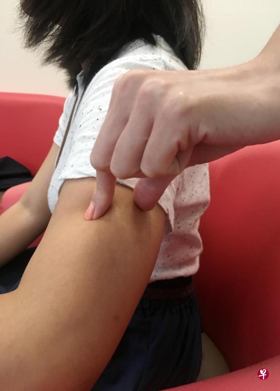 被告用指甲捏伤女佣。(示意图) 被告用指甲捏伤女佣。(示意图)