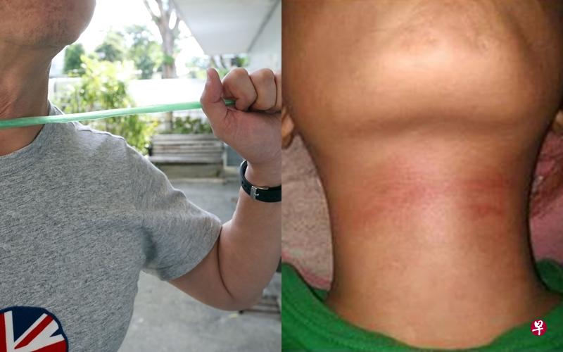女网友称友人在骑行电动踏板车送餐时,被细绳绊倒,颈项留下触目惊心的红痕,左图为示意图。(取自面簿) 女网友称友人在骑行电动踏板车送餐时,被细绳绊倒,颈项留下触目惊心的红痕,左图为示意图。(取自面簿)