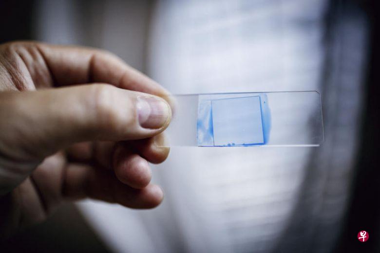 《纽约时报》早前报道,这种名为“耳念珠菌”的新型抗药性细菌席卷全球。(纽约时报) 《纽约时报》早前报道,这种名为“耳念珠菌”的新型抗药性细菌席卷全球。(纽约时报)