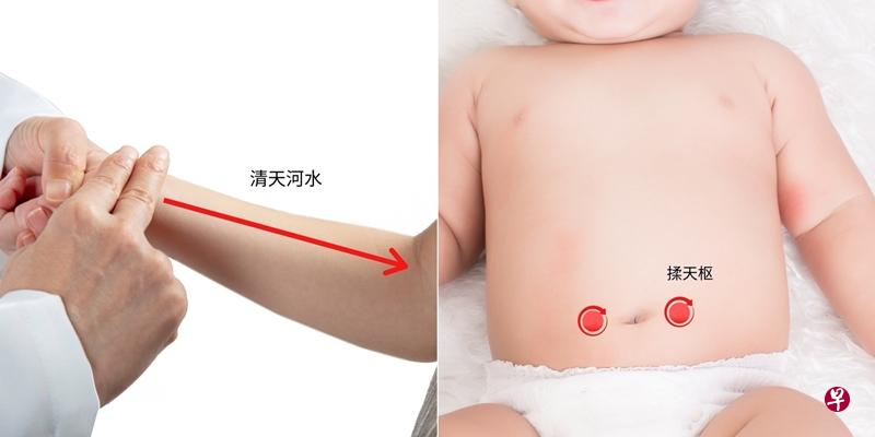 孩童便秘可以推拿什么穴位?(余仁生中医提供) 孩童便秘可以推拿什么穴位?(余仁生中医提供)