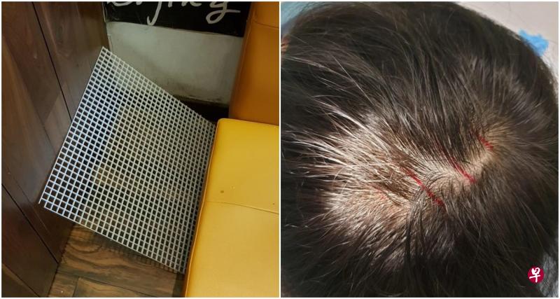 半公斤重的通风冷气格栅从三米高处的天花板坠下,砸中男童头顶,留下四条血痕。 半公斤重的通风冷气格栅从三米高处的天花板坠下,砸中男童头顶,留下四条血痕。