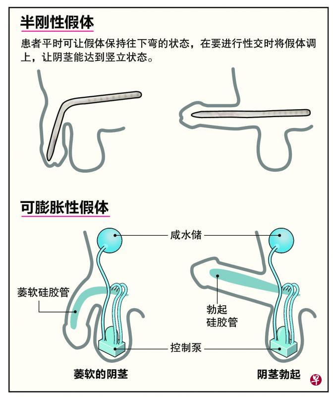 (医生提供图像) (医生提供图像)