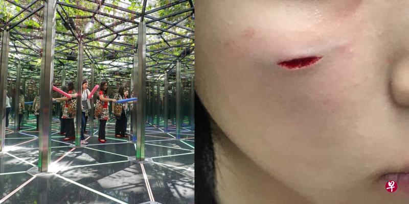 14岁少女昨天到星耀樟宜的镜子迷宫(左图)游玩时割伤,脸上留下一道伤痕,缝了九针。(档案照/取自面簿) 14岁少女昨天到星耀樟宜的镜子迷宫(左图)游玩时割伤,脸上留下一道伤痕,缝了九针。(档案照/取自面簿)