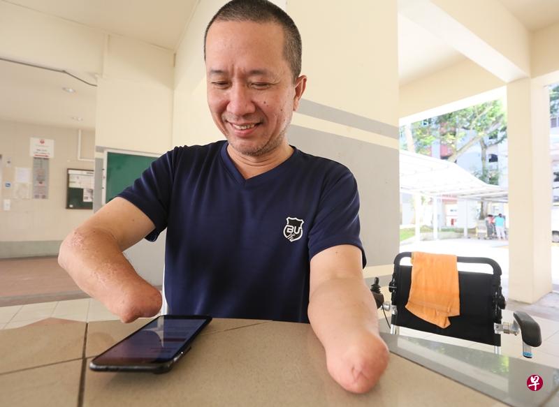 陈惠文虽没装上手部义肢,但仍能如常使用电脑与手机。(洪璐华摄) 陈惠文虽没装上手部义肢,但仍能如常使用电脑与手机。(洪璐华摄)