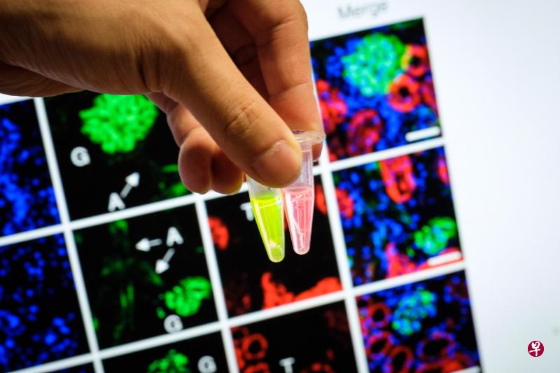 南洋理工大学科学家研发的探测物,加入含有急性肾衰竭生物标记的尿液样本后,在紫外线照明下会发出荧光色。(南洋理工大学提供) 南洋理工大学科学家研发的探测物,加入含有急性肾衰竭生物标记的尿液样本后,在紫外线照明下会发出荧光色。(南洋理工大学提供)