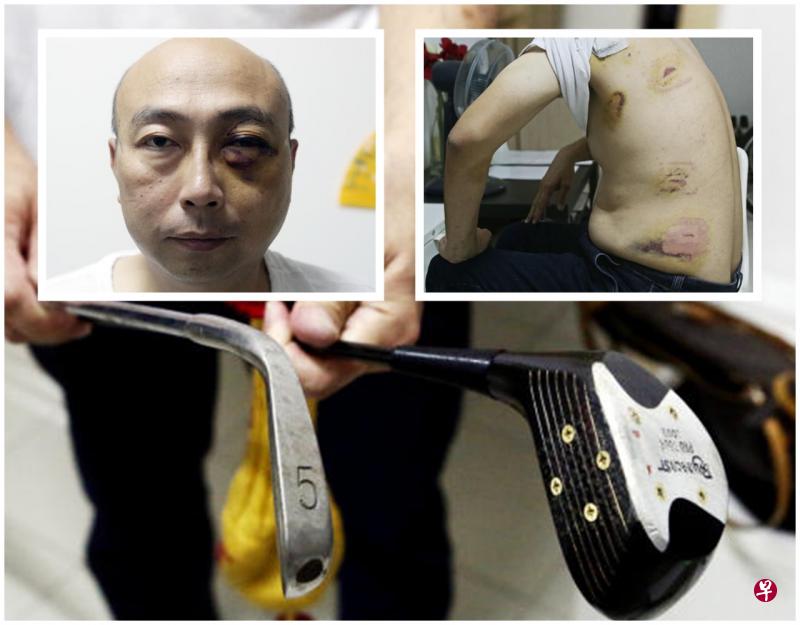被告用高尔夫球杆打伤丈夫钟正业。(档案照) 被告用高尔夫球杆打伤丈夫钟正业。(档案照)